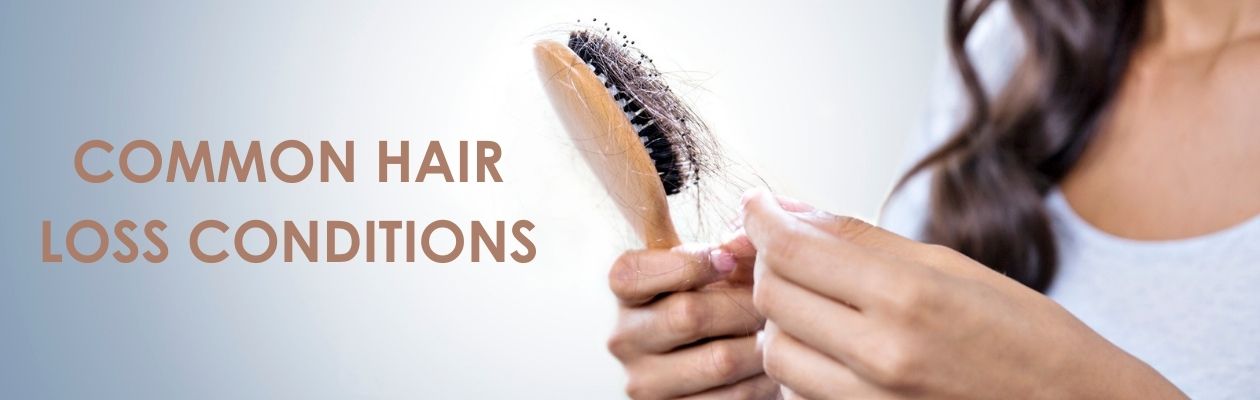 Common Hair Loss Conditions Rituals Hair Lab Gainsborough